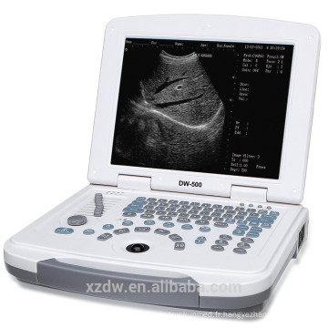 Scanner d&#39;ultrason d&#39;ordinateur portable de DW-500 et machine d&#39;ultrason avec la batterie